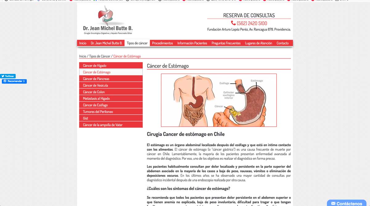 Cirugía y tratamientos contra el cáncer en Chile